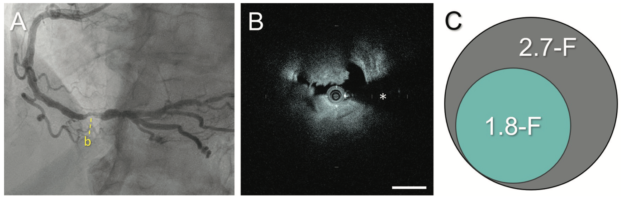 Bezerra Gentuity Figure 2