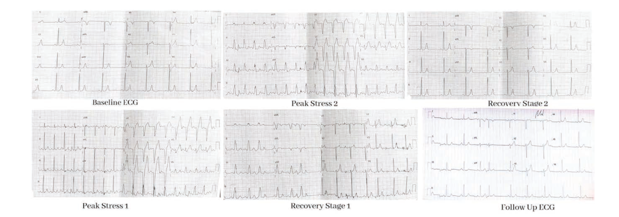 Bhattad - Figure 1 - June 2024