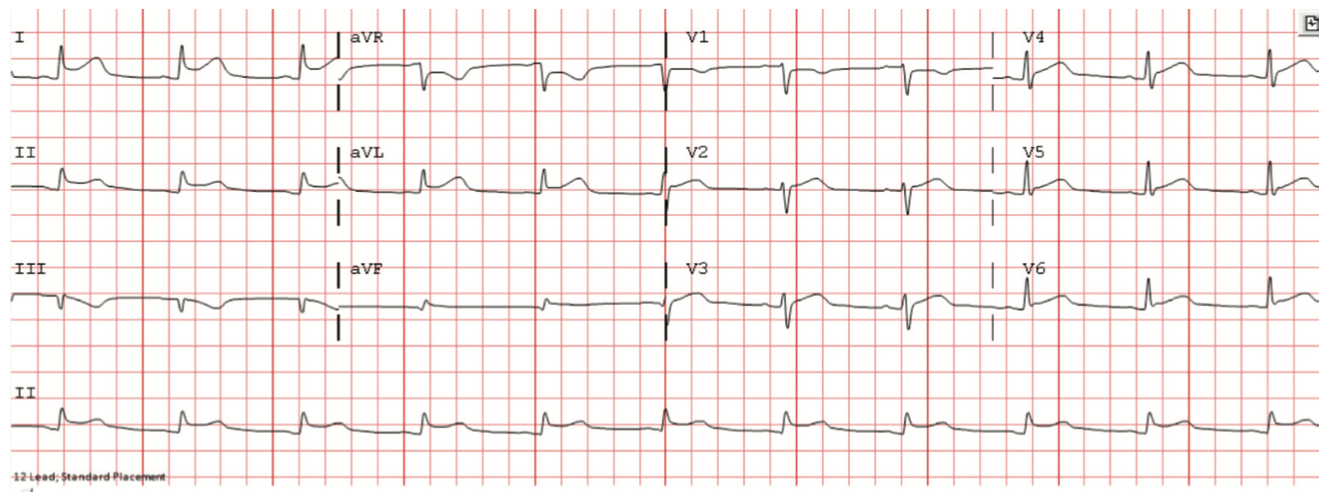 Bhattad Pericarditis Figure 1