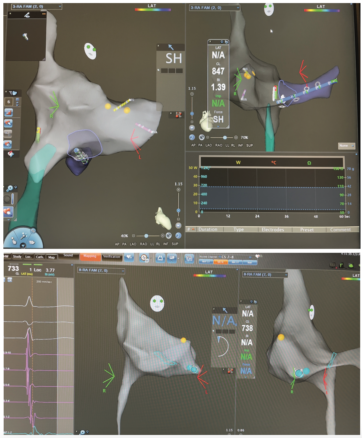 Bonilla AdventHealth Orlando Figure 3