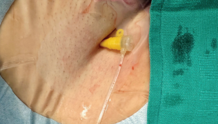 Bumgarner-Fig3-April 2025.png 