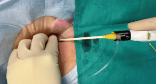 Bumgarner-Fig5-April 2025.png 