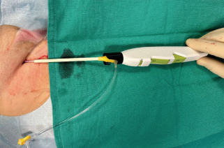 Bumgarner-Fig6-April 2025.png 