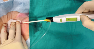 Bumgarner-Fig7-April 2025.png 