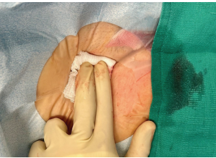 Bumgarner-Fig8-April 2025.png 