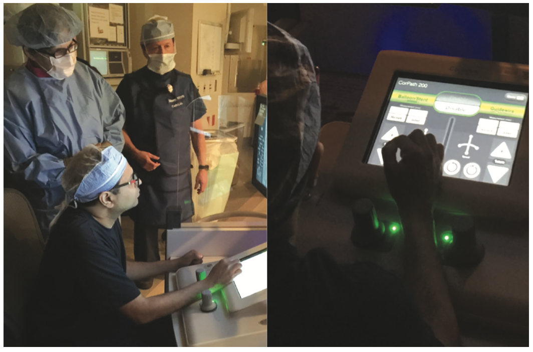 Byers Corindus Figure 4