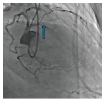 CLD Heo Figure 1 Feb 2025