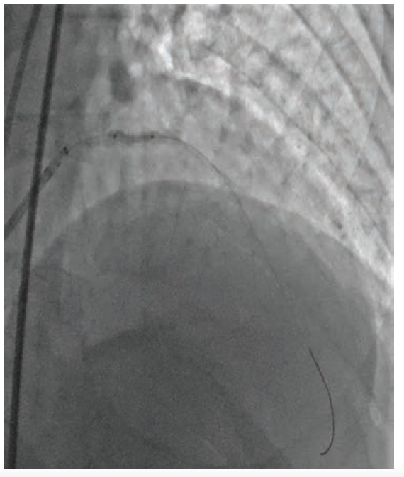 CLD Heo Figure 2 Feb 2025