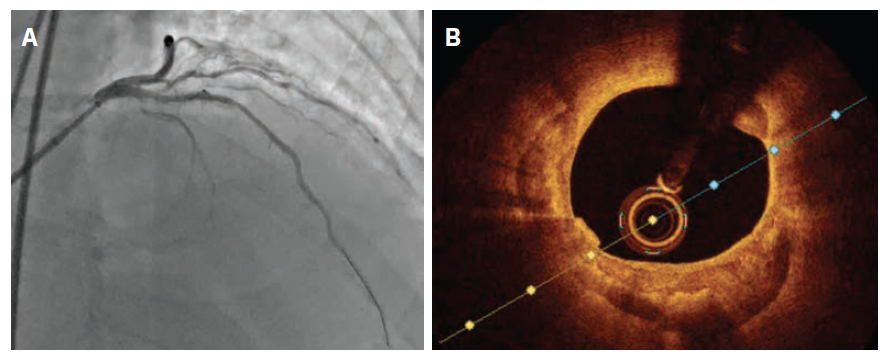 CLD Heo Figure 3 Feb 2025