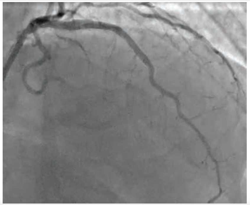 CLD Heo Figure 5 Feb 2025