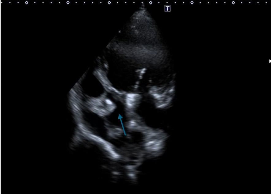 Figure 4B Transthoracic echocardiography. 