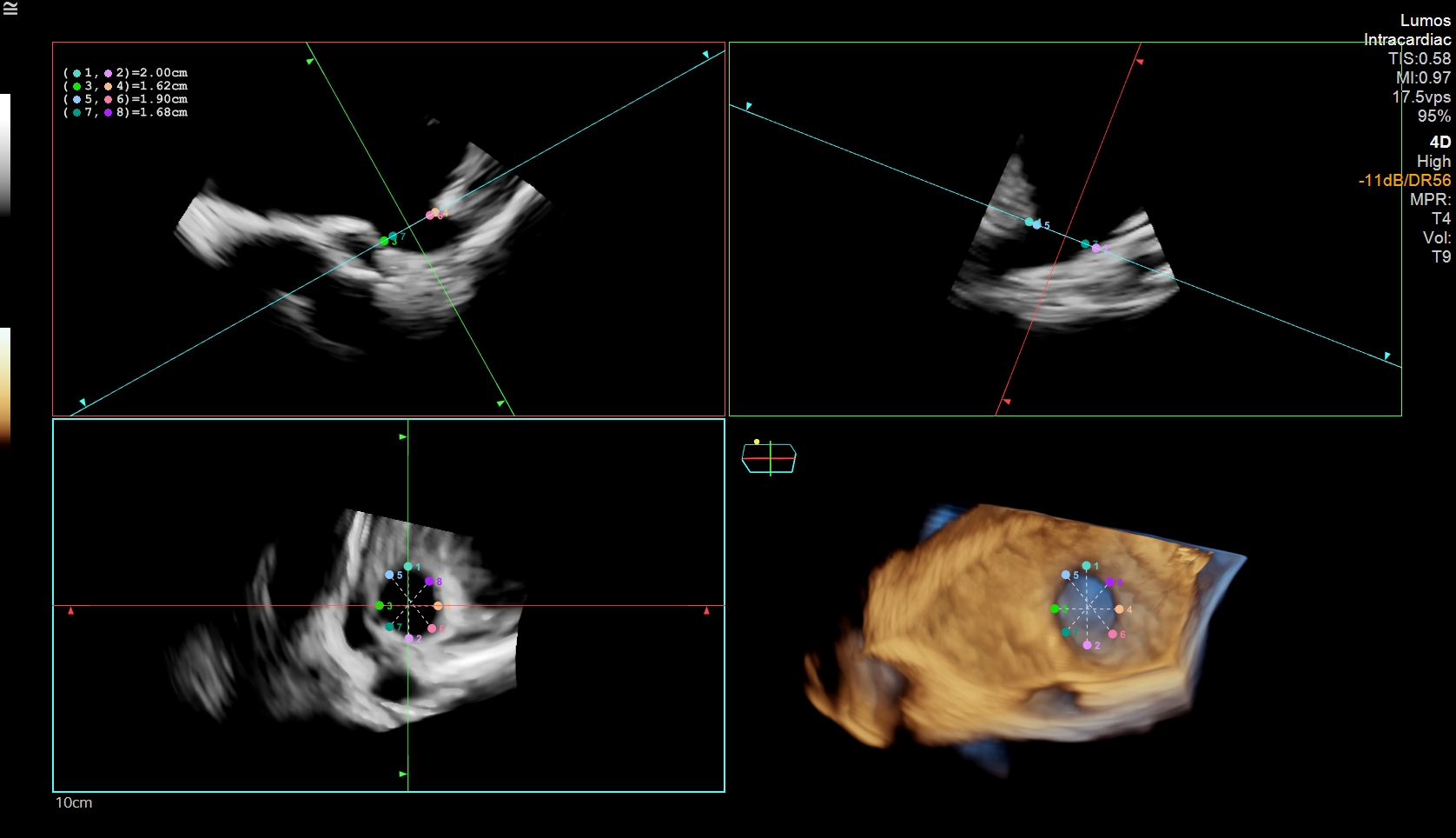 Figure 1. Landing zone and device sizing. 