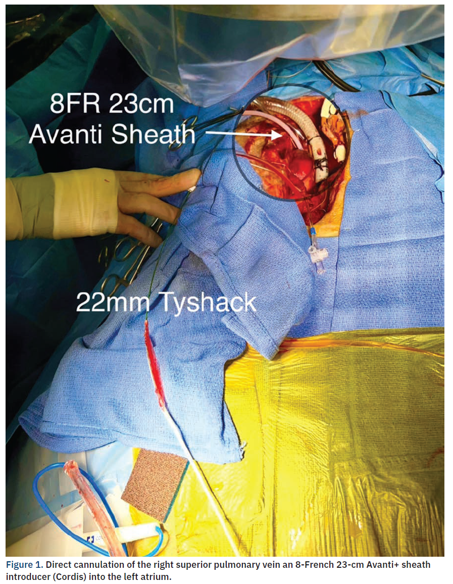 Casazza Figure 1 CLD Apr 2024