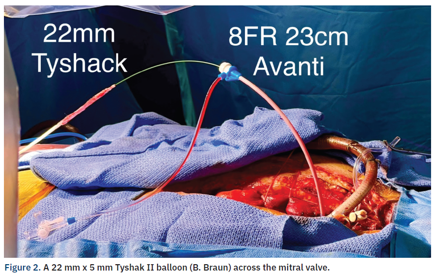 Casazza Figure 2 CLD Apr 2024
