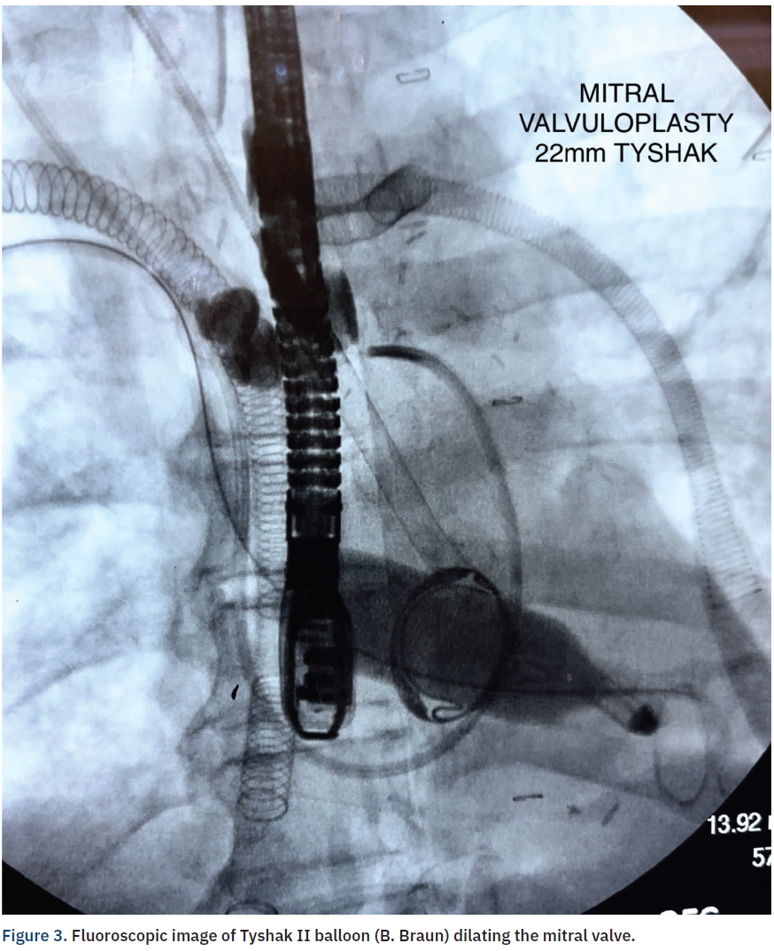 Casazza Figure 3 CLD Apr 2024