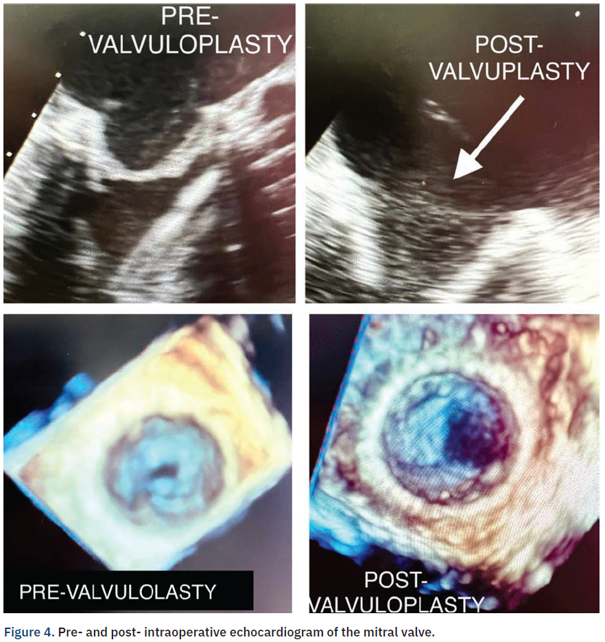 Casazza Figure 4 CLD Apr 2024
