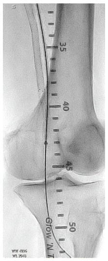 CLD-Endologix-Fig5.png 