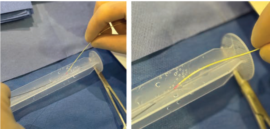CLD-Feb 2025-Kern-Fig2
