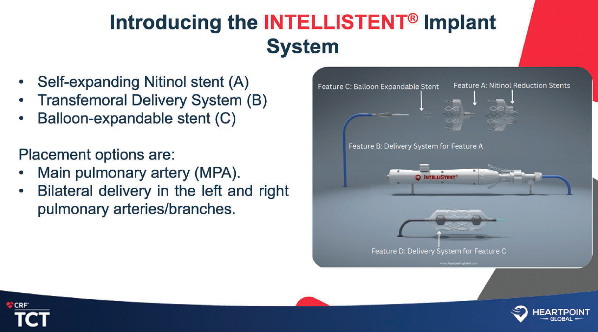 Heartpoint Global's IntelliStent