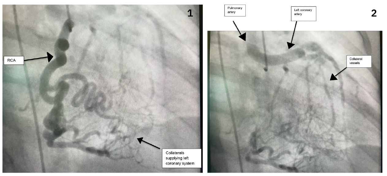CLD Khan Figures 1-2