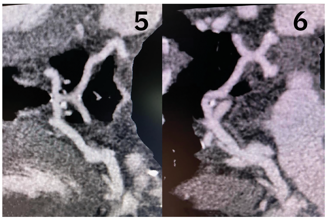 CLD Khan Figures 5-6