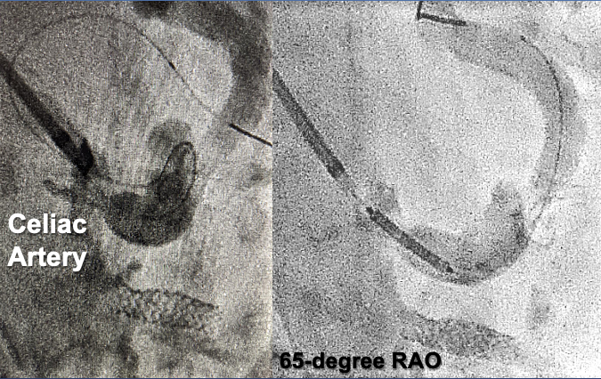 Minor Figure 11A-B