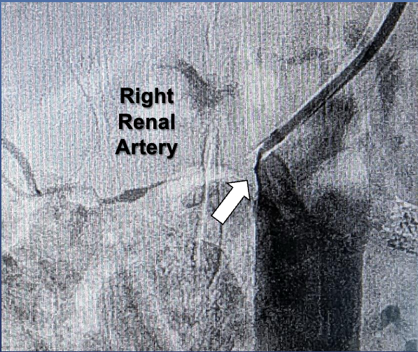 Minor Figure 3