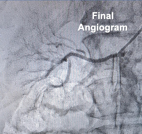 Minor Figure 5B