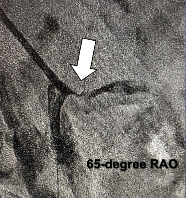 Minor Figure 9A