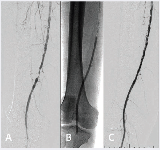 CLD-Paisley-Case1-Fig1