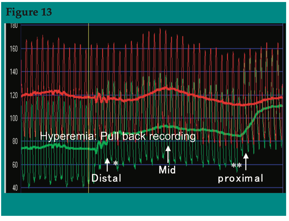 CLD Pijls Figure 13