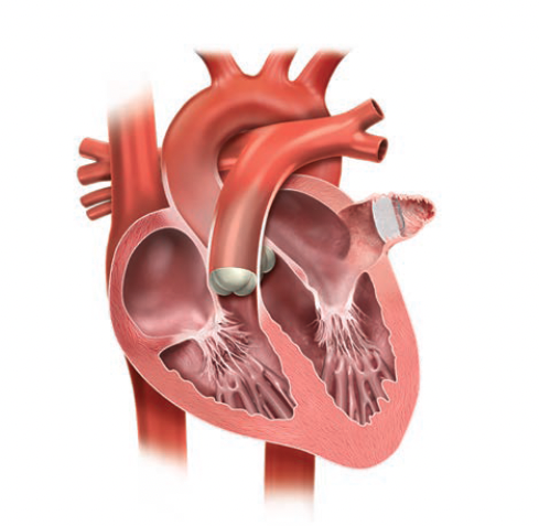 Speiser et al Figure 1
