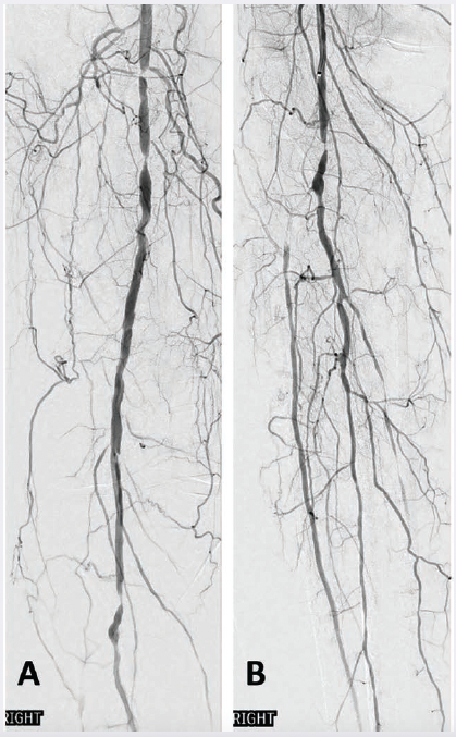 CLD-Ullery-Case1-Fig1