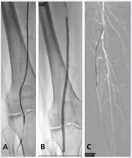 Ullery Case 1, Figure 2