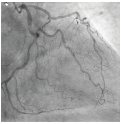 CLD Vilchez Figure 1