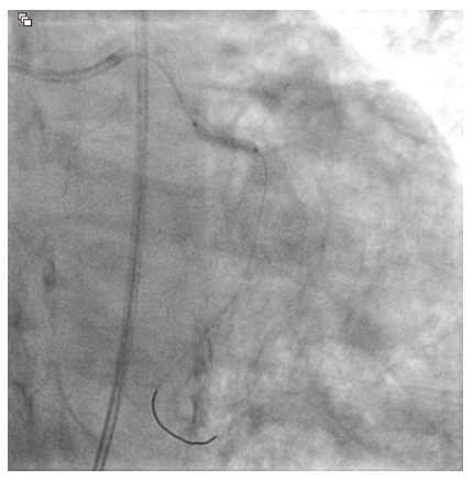 CLD Vilchez Figure 3