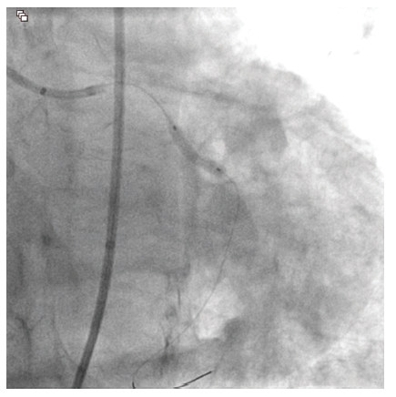 CLD Vilchez Figure 4