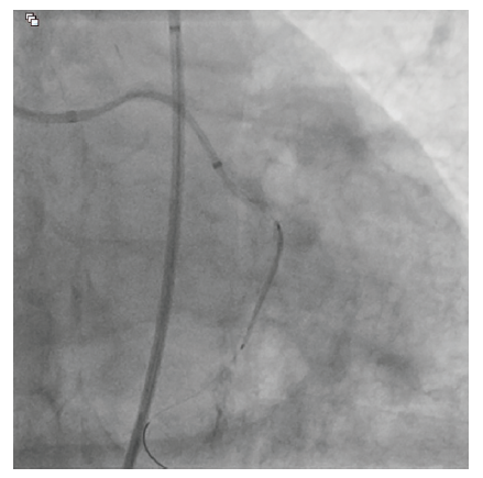 CLD Vilchez Figure 5