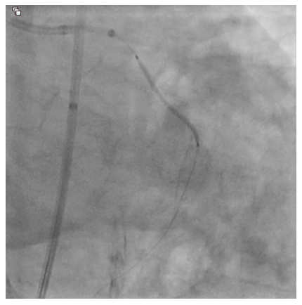 CLD Vilchez Figure 6