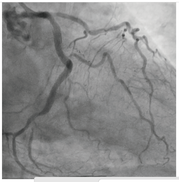 CLD Vilchez Figure 7