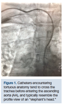 CLDDec2018_CasazzaFigure1
