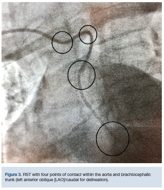 CLDDec2018_CasazzaFigure3
