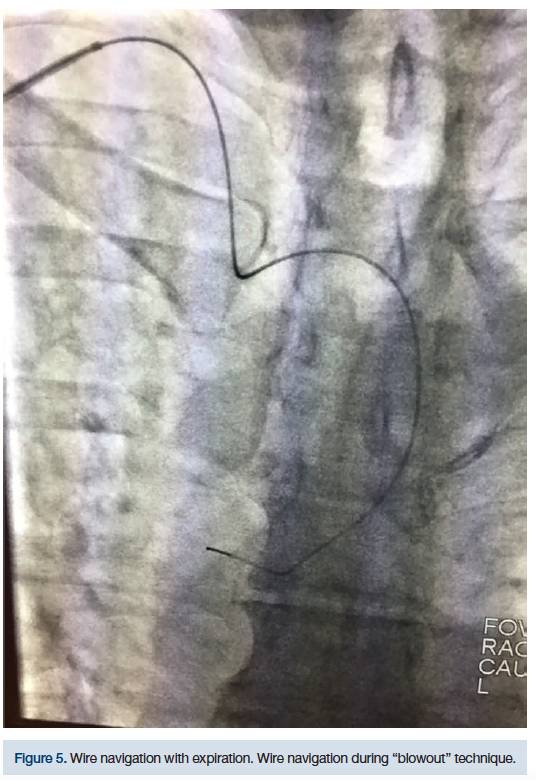 CLDDec2018_CasazzaFigure5