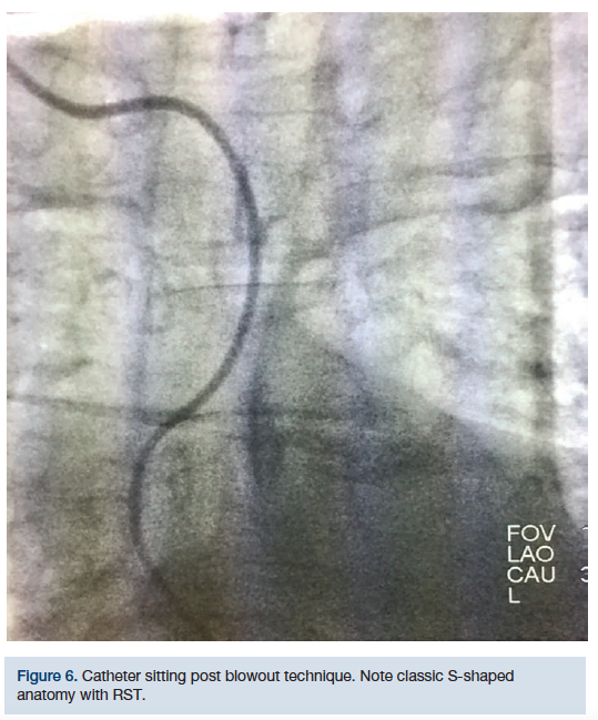 CLDDec2018_CasazzaFigure6