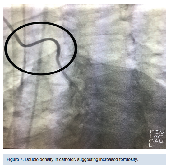 CLDDec2018_CasazzaFigure7