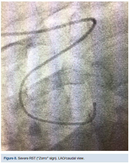 CLDDec2018_CasazzaFigure8