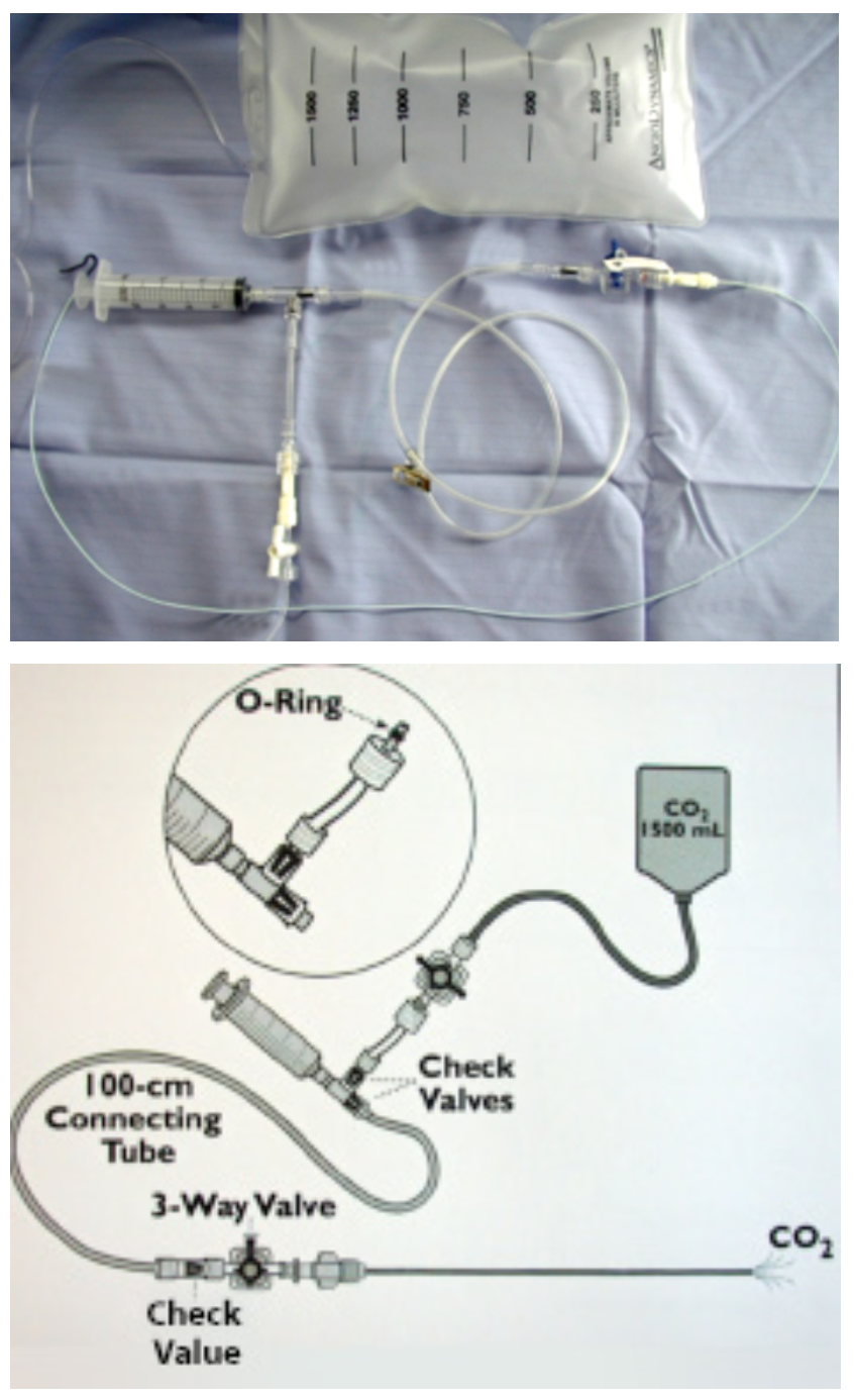 Caridi Digital Subtraction Angiography Figure 45