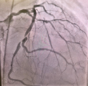 Casazza Figure 2  July 2024