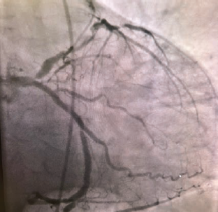 Casazza Figure 3  July 2024