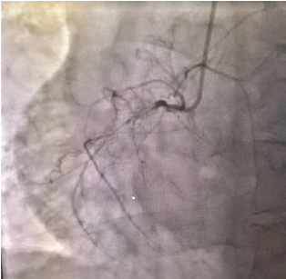 Casazza Figure 4  July 2024